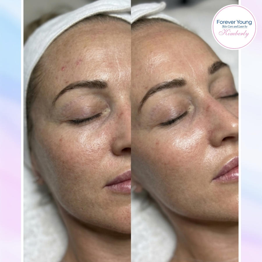 Skincare